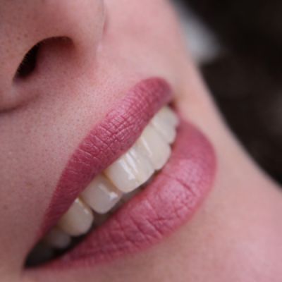 ajaktetovalas-gyor-gyogyult